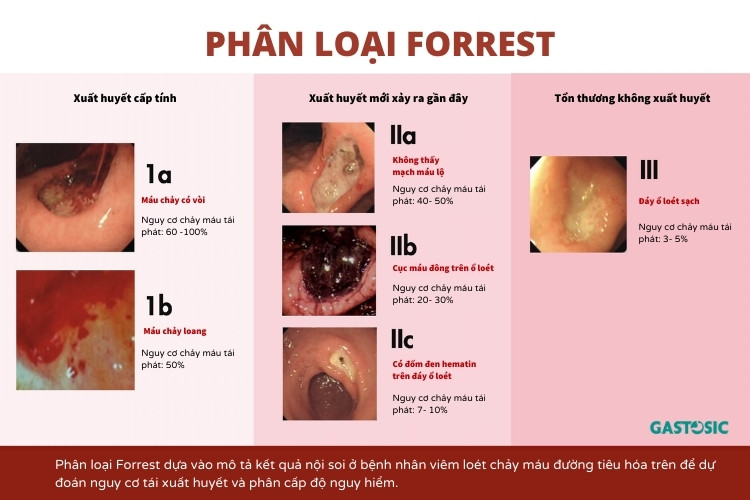 phan-loai-forrest.jpg